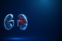 Minuman bersoda terlihat menyegarkan, tetapi konsumsi berlebihan bisa membebani ginjal.