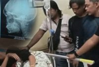 Korban tertancap kunci di tengkorak kepala kepala terbaring di RS (Foto: Istimewa)