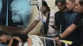 Korban tertancap kunci di tengkorak kepala kepala terbaring di RS (Foto: Istimewa)