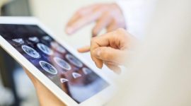 Ilustrasi pemeriksaan hasil pemindaian otak menggunakan perangkat digital dalam proses diagnosis kanker otak. (Foto: Ilustrasi)