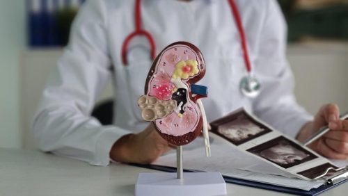 Model anatomi ginjal terlihat di meja konsultasi dokter.