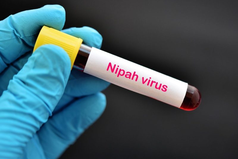 Petugas kesehatan memantau kesiapsiagaan pencegahan virus Nipah meski Indonesia belum mencatat kasus terkonfirmasi.
