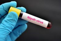 Petugas kesehatan memantau kesiapsiagaan pencegahan virus Nipah meski Indonesia belum mencatat kasus terkonfirmasi.