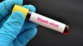Petugas kesehatan memantau kesiapsiagaan pencegahan virus Nipah meski Indonesia belum mencatat kasus terkonfirmasi.