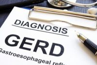 Ilustrasi diagnosis GERD yang sering dipicu kebiasaan hidup tidak sehat