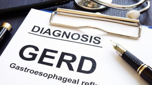 Ilustrasi diagnosis GERD yang sering dipicu kebiasaan hidup tidak sehat