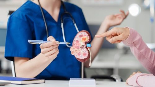 Ilustrasi ginjal manusia yang menunjukkan dampak konsumsi gula berlebih terhadap kesehatan ginjal.