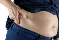 Foto: Ilustrasi Perut Buncit (Pixabay)