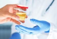 Urine yang jernih biasanya sehat, sementara urine keruh atau berwarna merah muda perlu diperiksa
