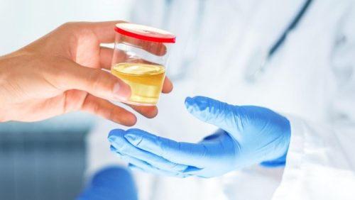Urine yang jernih biasanya sehat, sementara urine keruh atau berwarna merah muda perlu diperiksa