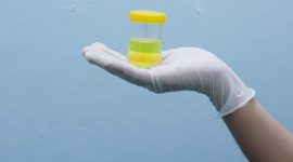 Ilustrasi urine dengan warna berbeda yang dapat menunjukkan kondisi kesehatan, mulai dari dehidrasi hingga gangguan ginjal.