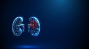 Ilustrasi digital organ ginjal dengan tanda target merah yang melambangkan kanker ginjal.
