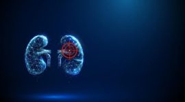 Ilustrasi kanker ginjal yang menggambarkan adanya sel abnormal pada organ ginjal yang dapat dipicu oleh berbagai faktor risiko, termasuk gaya hidup tidak sehat.