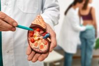 Studi terbaru memprediksi kasus kanker ginjal global dapat meningkat hingga dua kali lipat pada 2050.