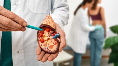 Studi terbaru memprediksi kasus kanker ginjal global dapat meningkat hingga dua kali lipat pada 2050.